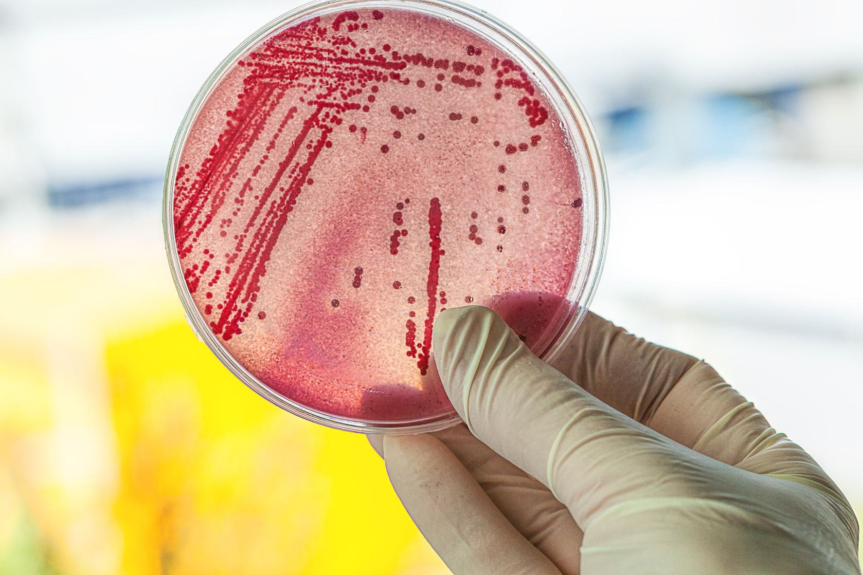 Petri dish showing cultured bacteria